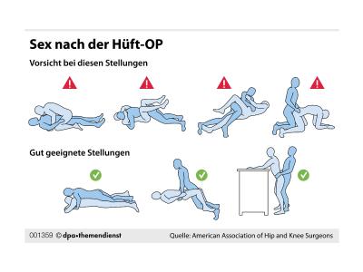 Sex nach Hüft-OP
